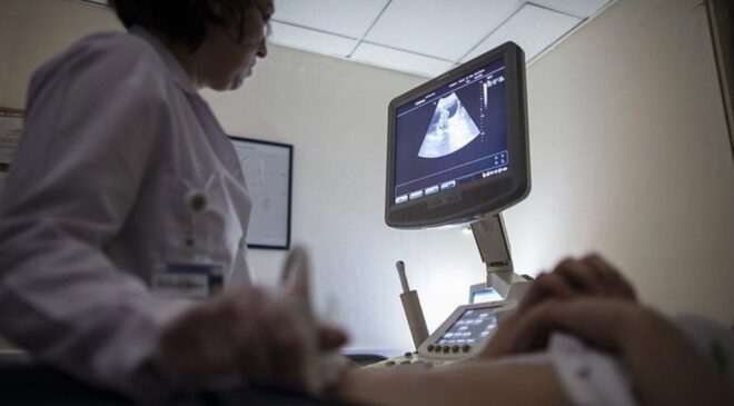 Endometriozis: Çikolata Kisti ve Kısırlık Üzerindeki Etkileri Gözden Geçiriliyor