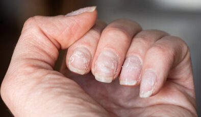 Saç, Tırnak ve Sağlık: Erken Uyarı Sistemimizdeki İşaretler